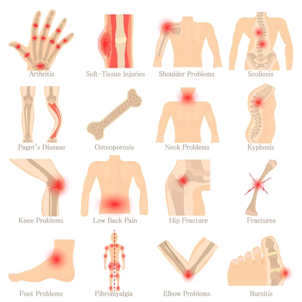 Conjunto de iconos de enfermedades ortopédicas, estilo de dibujos animados — Vector de stock