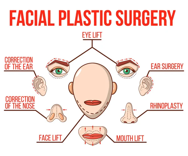 Banner de conceito de cirurgia plástica facial, estilo de desenho animado — Vetor de Stock