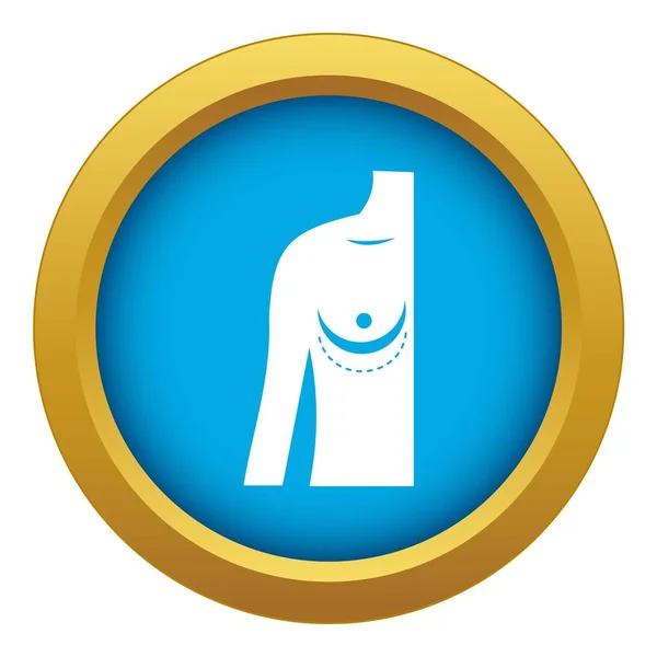 Cirugía de implantes mamarios. icono azul vector aislado — Vector de stock