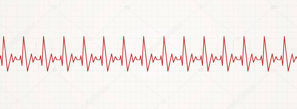 illustration of rapid irregular heart pulsating rhythm