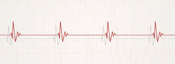Медичний Банер Ілюструє Бродикардію Серцевий Ритм Менше Ударів Хвилину — стокове фото