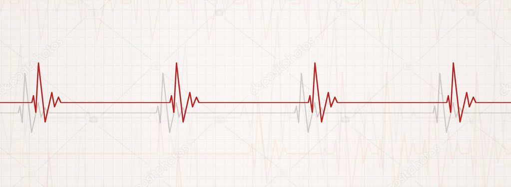 medicine banner illustrating brodycardia. heart rate less than 60 beats per minute