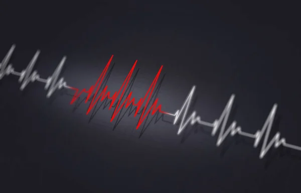 Arritmia Ilustração Médica Coração Pulsante Irregular — Fotografia de Stock