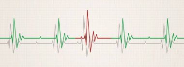 düzensiz kalp gösteren tıp afiş üzerinde EKG monitör yendi.