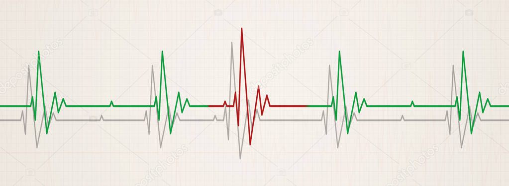 medicine banner illustrating irregular heart beat on ecg during monitor