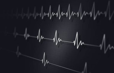 kalp titreşimli, tıbbi geçmişi hızlı normal ve yavaş 