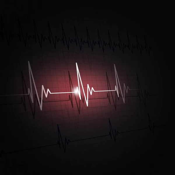 Ritmo de um ecg do coração — Fotografia de Stock