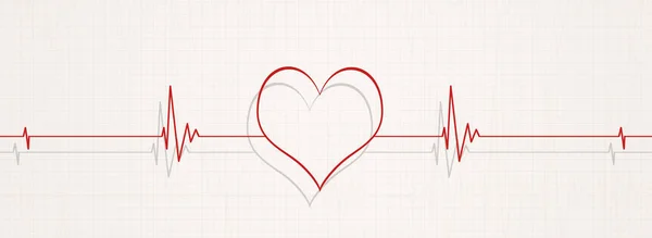 EKG hjärtslag illustration — Stockfoto