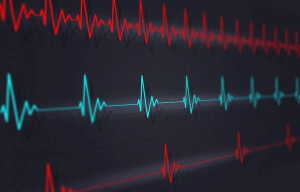 Fast Normal Slow Heartbeat Examples