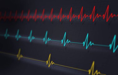 Hızlı Normal Yavaş Kalp Atışı ekg