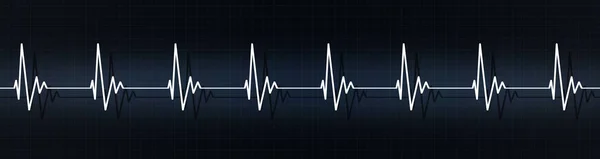 Battiti cardiaci su ecg — Foto Stock