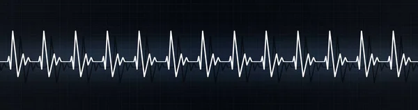 rapid heart pulse beats on ecg