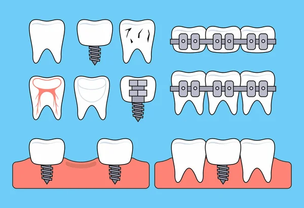 Iconos Dentales Estilo Delgada Línea Aislado Sobre Fondo Azul — Archivo Imágenes Vectoriales