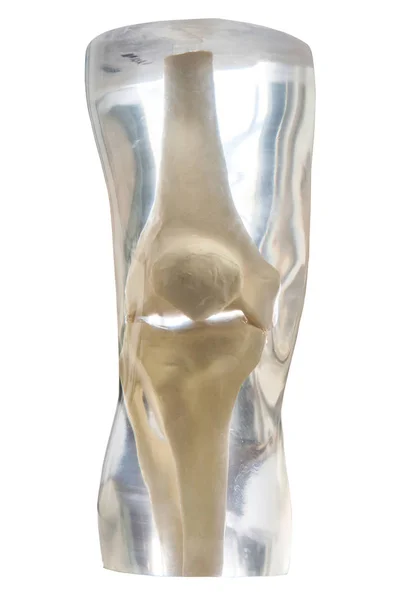 X-ışını Phantom diz, şeffaf beyaz arka plan üzerinde izole