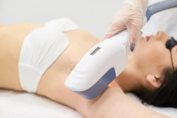 Medische Procedure Laser Ontharing Verwijderen Van Onderarm Haren Lichte Huid — Stockfoto