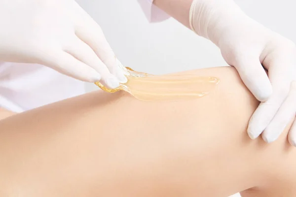 Wachsendes Frauenbein Zucker Haarentfernung Laserservice Epilation Salon Wachs Kosmetikerin Verfahren — Stockfoto