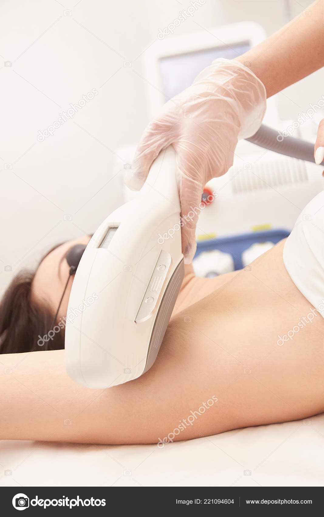 Fotodepilacion ipl antes y despues de adelgazar