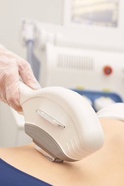 Saç lazer kaldırma hizmet. IPL kozmetik aygıt. Profesyonel aparatı. Kadın yumuşak deri care.stomach