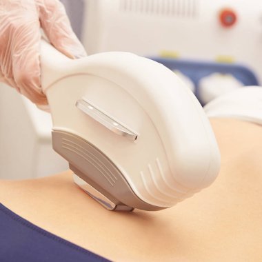 Sağlık Güzellik Lazer cosmeology yordam. Salonunda genç kadın. Profesyonel doktor. Kadın Cilt Bakımı teknolojisi. Epilasyon.