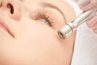 Mikrodermabrazyon klinik tedavi. Estetik yüz prosedür. Elmas yüz temiz. Anti akne ve hiperpigmentasyon tıp güzellik kozmetik. Güzellik uzmanı el.