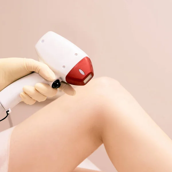 Hair Remove Laser Treatment Medical Removal Machine — Stock Photo, Image