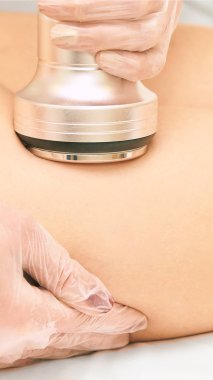 Kavitasyon makinesi terapisi. Kadın vücut yağ aldırma tedavisi. Ultrason salon aygıt. Radyo frekansı kozmetik prosedür.