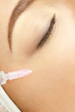 Kadın yüz kozmetik tedavi. Biorevitalization cilt tedavisi. Doktor dolgu ekleyin. Kız klinik yüz MEZOTERAPİSİ. Tıbbi salonda enjekte.