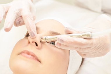Mikro dermbration kozmetik tedavi. Yüz elmas peeling. Anti akne yordamı. Kadın ve doktor eller. Tıbbi donanımı