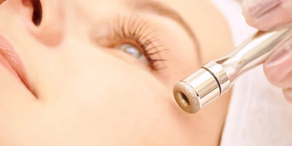 Tratamiento clínico de microdermoabrasión. Procedimiento facial estético. Cara de diamante limpia. Medicina belleza anti acné e hiperpigmentación cosmética. Cosmetólogo mano —  Fotos de Stock