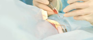 Oftalmoloji lazer mikroskop operasyonu. Klinikte doktor. Hasta göz tedavisi. Miyopi ve katarakt giderme