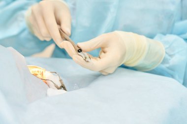 Oftalmoloji lazer mikroskop operasyonu. Klinikte doktor. Hasta göz tedavisi. Miyopi ve katarakt giderme