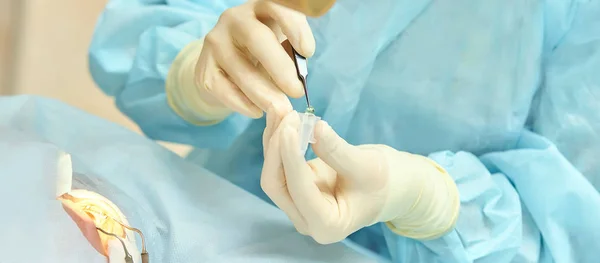 Operación de microscopio láser oftalmológico. Doctor en clínica. Tratamiento ocular del paciente. Miopía y eliminación de cataratas —  Fotos de Stock