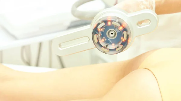 Cavitation cosmetology woman procedure. Lipo ultrasonic machine. Body anti cellulite treatment. Ultrasound radio girl therapy — Stock Photo, Image