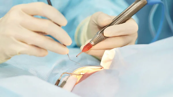 Ophthalmology laser microscope operation. Doctor in clinic. Patient eye treatment. Myopia and cataract removal — Stock Photo, Image