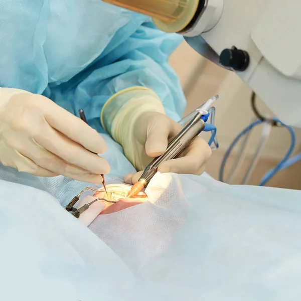 Operación de microscopio láser oftalmológico. Doctor en clínica. Tratamiento ocular del paciente. Miopía y eliminación de cataratas — Foto de Stock