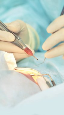 Oftalmoloji lazer mikroskop operasyonu. Klinikte doktor. Hasta göz tedavisi. Miyopi ve katarakt giderme