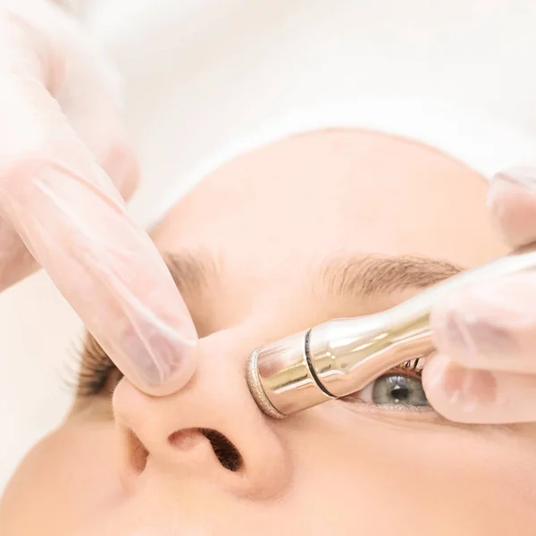 Mikrodermbration kosmetologische Behandlung. Gesichtsdiamantpeeling. Anti-Akne-Verfahren. Frauen- und Arzthände. Medizinisches Gerät — Stockfoto