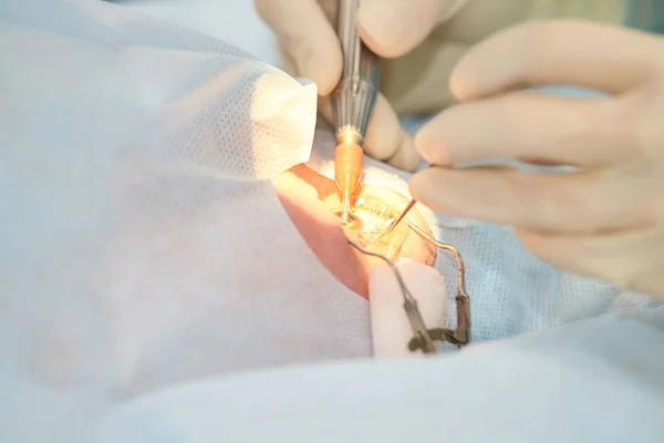 Operação de microscópio a laser oftalmológico. Doutor na clínica. Tratamento ocular do paciente. Miopia e remoção de catarata — Fotografia de Stock