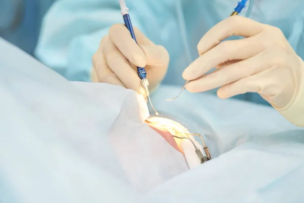 Operação de microscópio a laser oftalmológico. Doutor na clínica. Tratamento ocular do paciente. Miopia e remoção de catarata — Fotografia de Stock