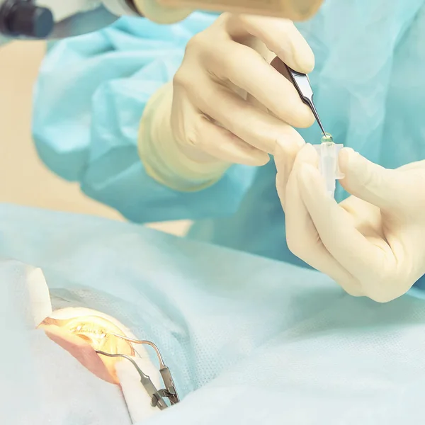 Ophthalmology laser microscope operation. Doctor in clinic. Patient eye treatment. Myopia and cataract removal — Stock Photo, Image