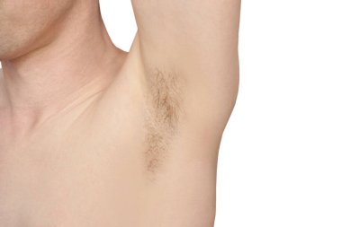 Koltuk altı kızı. Beyaz adam koltukaltı. Epilasyondan önce ve sonra.