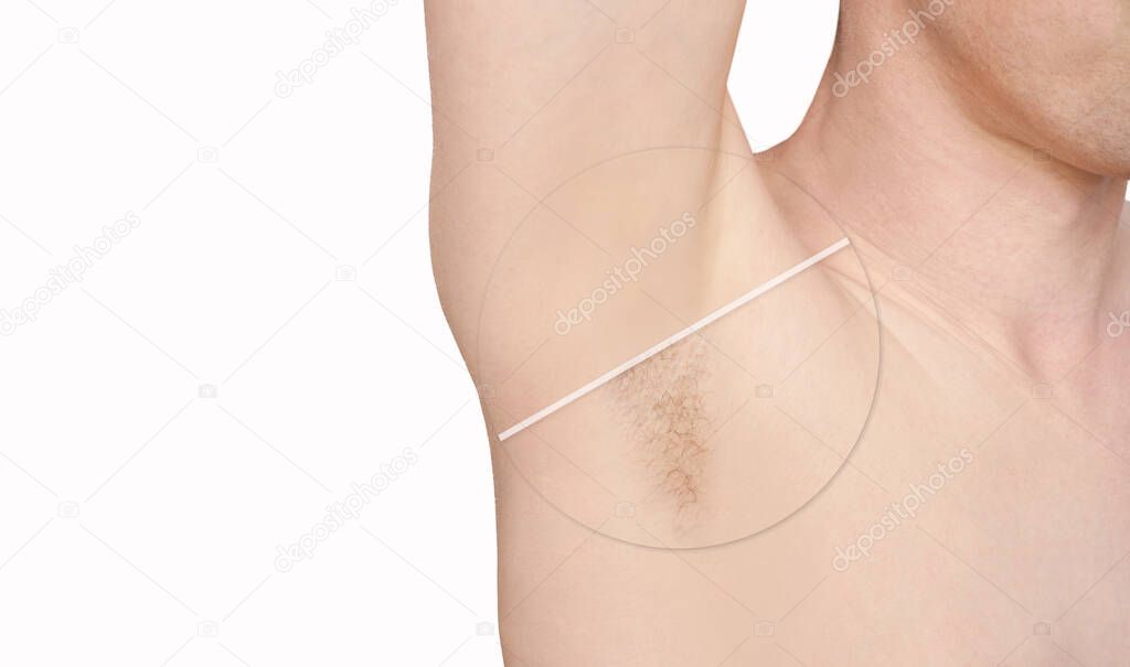 Girl underarm. White man armpit. Before and after epilation.