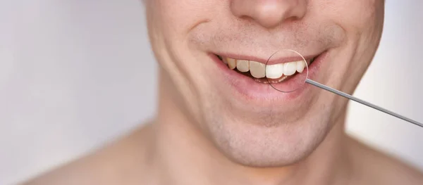 Men smile. Whitening oral care concept.