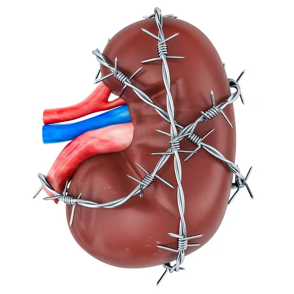 Kidney Pain concept. Human kidney with barbed wire. 3D rendering isolated on white background