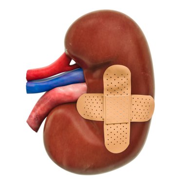 Human kidney with adhesive bandages. Treatment of kidneys concept, 3D rendering isolated on white background clipart