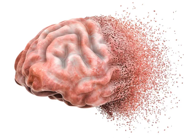 Brain Disease Destruction Memory Loss Concept Rendering Isolated White Background — Stock Photo, Image