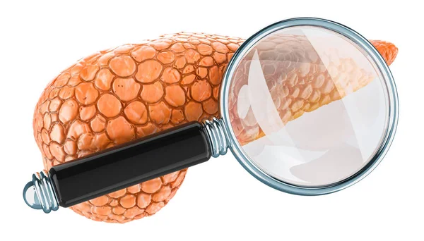 Menselijke Alvleesklier Met Vergrootglas Onderzoek Diagnose Van Alvleesklier Concept Rendering — Stockfoto