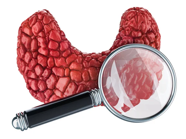 Людська Щитовидна Залоза Збільшувальним Склом Дослідження Діагностика Концепції Щитовидної Залози — стокове фото