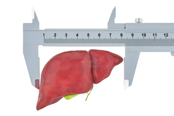 Menselijke Lever Met Schuifmaat Gemeten Onderzoek Diagnose Van Lever Concept — Stockfoto