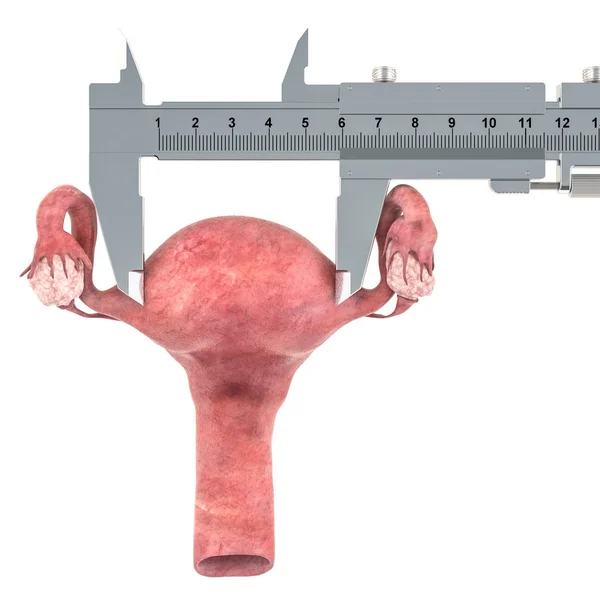 Utérus Avec Étrier Vernier Recherche Diagnostic Concept Utérin Rendu Isolé — Photo